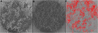 Visualizing Water Desaturation in Frozen Gas Diffusion Layers With Flow Field Segmentation via Synchrotron X-Ray Radiography